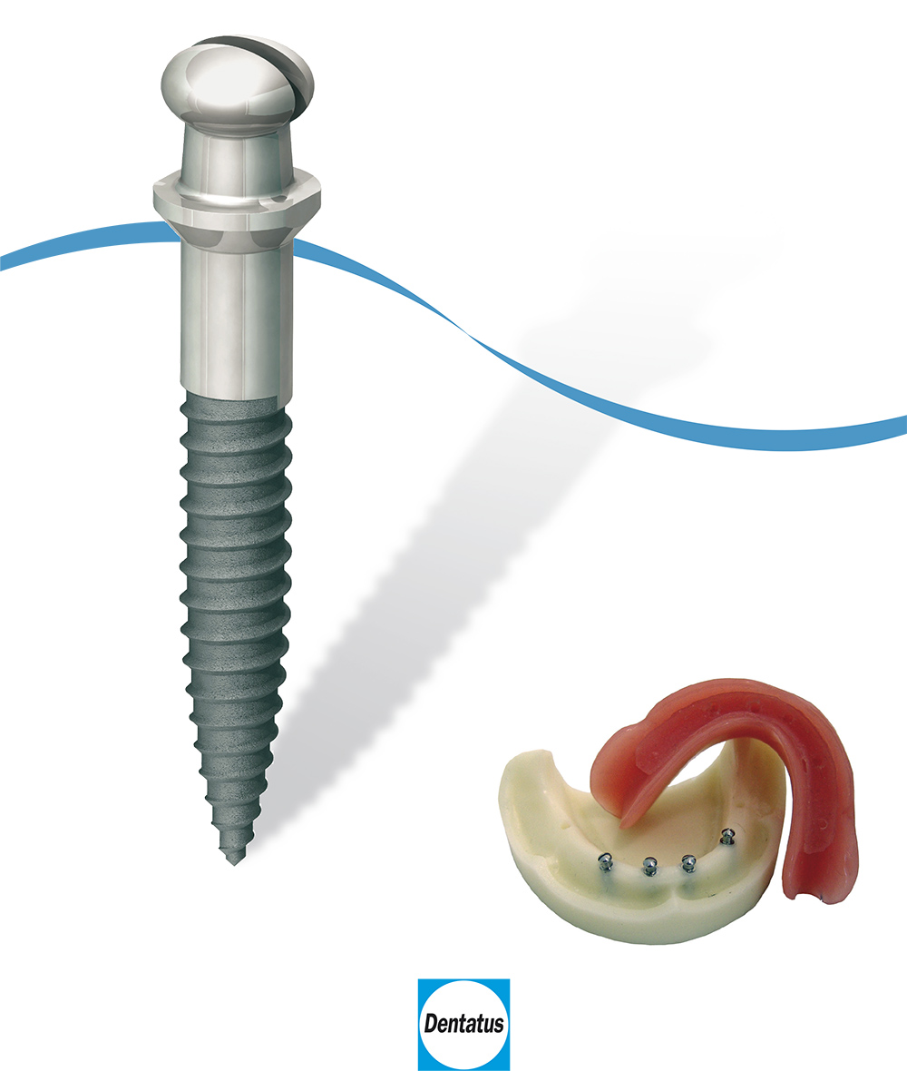 Implant étroit ATLAS Dentatus